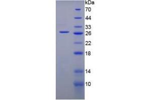SDS-PAGE analysis of Mouse Gremlin 1 Protein. (GREM1 Protéine)