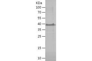 Western Blotting (WB) image for Melanoma Antigen Family A, 8 (MAGEA8) (AA 1-318) protein (His tag) (ABIN7123892) (MAGEA8 Protein (AA 1-318) (His tag))