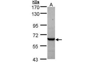 TCP1 epsilon Antibody staining of A431 (A) whole cell lysate (30 µg) at 1/1000 dilution, 7. (CCT5 anticorps  (AA 1-224))