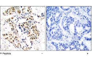 Image no. 1 for anti-Ataxia Telangiectasia Mutated (ATM) (pSer1981) antibody (ABIN196823) (ATM anticorps  (pSer1981))