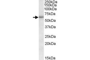 CDH23 polyclonal antibody  (1 ug/mL) staining of human amygdala lysate (35 ug protein in RIPA buffer).