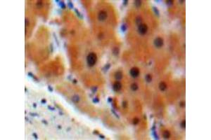 Used in DAB staining on fromalin fixed paraffin-embedded Liver tissue (C4BPA anticorps  (AA 548-597))