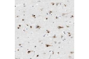 Immunohistochemical staining of human cerebral cortex with RNF38 polyclonal antibody  shows strong nuclear and moderate cytoplasmic positivity in neuronal cells.