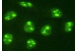 Immunocytochemistry (ICC) image for anti-PiggyBac Transposable Element Derived 5 (PGBD5) antibody (ABIN1112920) (PGBD5 anticorps)
