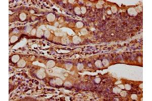 IHC image of ABIN7146972 diluted at 1:1000 and staining in paraffin-embedded human small intestine tissue performed on a Leica BondTM system.