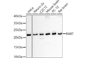 Western blot analysis of extracts of various cell lines, using R antibody (ABIN6133888, ABIN6146605, ABIN6146608 and ABIN6216535) at 1:1000 dilution. (RAB7A anticorps  (C-Term))