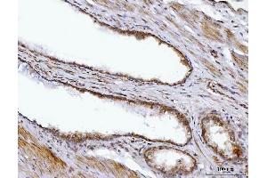 IHC analysis of BBS9 using anti-BBS9 antibody (ABIN7601518). (BBS9 anticorps  (AA 37-793))