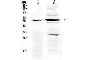 Western blot analysis of TNFRSF1A using anti- TNFRSF1A antibody . (TNFRSF1A anticorps  (AA 89-145))