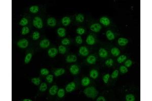 IF analysis of HnRNP H/HNRNPH1 using anti-HnRNP H/HNRNPH1 antibody (ABIN4886623). (HNRNPH1 anticorps  (N-Term))