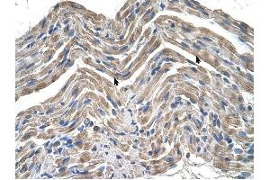 Neuroplastin antibody was used for immunohistochemistry at a concentration of 4-8 ug/ml to stain Skeletal muscle cells (arrows) in Human Muscle.