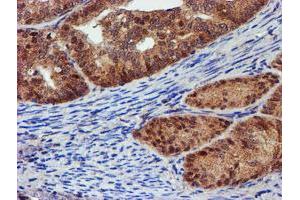 Image no. 1 for anti-Proteasome (Prosome, Macropain) 26S Subunit, Non-ATPase, 2 (PSMD2) antibody (ABIN1500479)