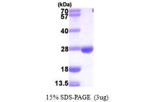 SDS-PAGE (SDS) image for Dihydrofolate Reductase (DHFR) (AA 1-187) protein (His tag) (ABIN667350) (Dihydrofolate Reductase Protein (DHFR) (AA 1-187) (His tag))