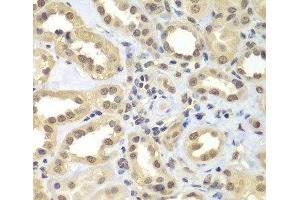 Immunohistochemistry of paraffin-embedded Human kidney using SUPT20H Polyclonal Antibody at dilution of 1:100 (40x lens). (FAM48A/P38IP anticorps)