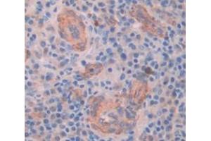 Used in DAB staining on fromalin fixed paraffin- embedded Kidney tissue (MYO5A anticorps  (AA 1531-1855))