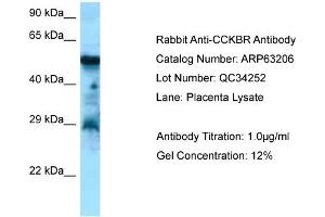 Western Blotting (WB) image for anti-Cholecystokinin B Receptor (CCKBR) (C-Term) antibody (ABIN2789413) (CCKBR anticorps  (C-Term))