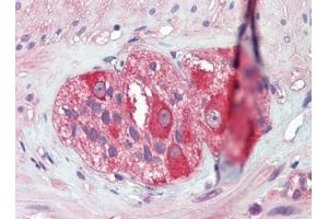 IHC Image for AP22893PU-N Small intestine, myenteric plexus, Human: Formalin-Fixed, Paraffin-Embedded (FFPE)