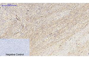 Immunohistochemical analysis of paraffin-embedded human uterus tissue. (MEK1/2 anticorps)