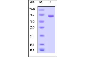 Biotinylated Human CD40, Fc,Avitag™ (MALS verified) on  under reducing (R) condition. (CD40 Protein (CD40) (AA 21-193) (Fc Tag,AVI tag,Biotin))