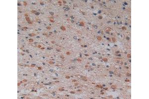 Used in DAB staining on fromalin fixed paraffin- embedded glioma tissue (GMFG anticorps  (AA 6-126))