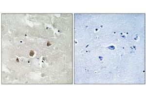 Immunohistochemical analysis of paraffin-embedded human brain tissue using MAP3K1 (Phospho-Thr1400) antibody (left)or the same antibody preincubated with blocking peptide (right). (MAP3K1 anticorps  (pThr1402))