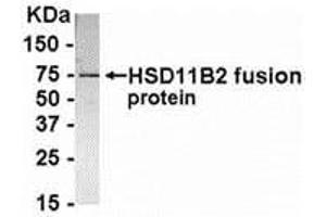 Western Blotting (WB) image for anti-Hydroxysteroid (11-Beta) Dehydrogenase 2 (HSD11B2) (AA 181-405) antibody (ABIN2468177) (HSD11B2 anticorps  (AA 181-405))
