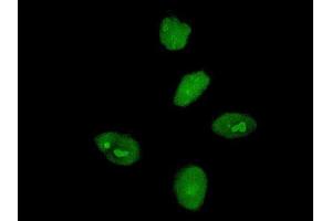 Immunofluorescence of monoclonal antibody to MKRN3 on HeLa cell. (MKRN3 anticorps  (AA 437-507))