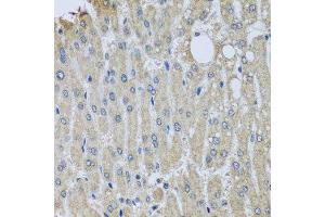 Immunohistochemistry of paraffin-embedded human liver injury using SYT11 antibody. (SYT11 anticorps  (AA 37-200))