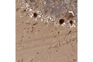Immunohistochemical staining of human cerebellum with MLF1IP polyclonal antibody  shows strong cytoplasmic and nuclear positivity in Purkinje cells at 1:50-1:200 dilution.