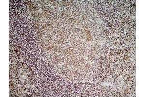 Immunohistochemistry (Frozen Sections) (IHC (fro)) image for anti-CD70 Molecule (CD70) antibody (ABIN316748) (CD70 anticorps)