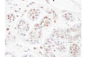 anti-PIN2/TERF1 Interacting, Telomerase Inhibitor 1 (PINX1) (AA 225-275) antibody