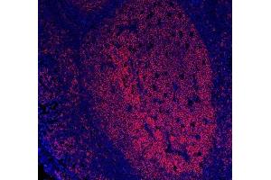 IF analysis of CD20/MS4A1 using anti-CD20/MS4A1 antibody (ABIN7599234). (CD20 anticorps  (AA 1-297))