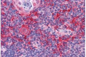 Human Thymus: Formalin-Fixed, Paraffin-Embedded (FFPE) (KLHL25 anticorps  (Internal Region))