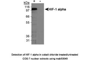 Image no. 7 for anti-Hypoxia Inducible Factor 1, alpha Subunit (Basic Helix-Loop-Helix Transcription Factor) (HIF1A) (AA 432-528) antibody (ABIN363203)