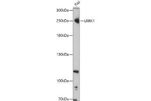 Western blot analysis of extracts of Raji cells, using LRRK1 antibody (ABIN7268231) at 1:1000 dilution. (LRRK1 anticorps  (AA 10-90))