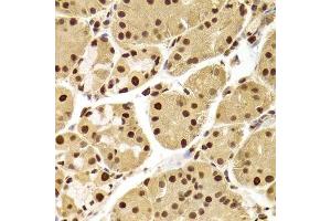 Immunohistochemistry of paraffin-embedded human stomach using ANP32A Antibody.