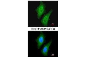 anti-Chromosome 9 Open Reading Frame 96 (C9orf96) (C-Term) antibody