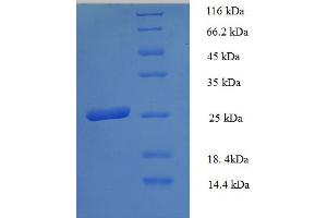 SDS-PAGE (SDS) image for Major Histocompatibility Complex, Class II, DP beta 1 (HLA-DPB1) (AA 30-225), (Extracellular) protein (His tag) (ABIN5712940)