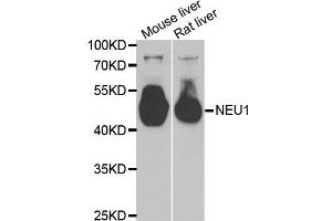 Western blot analysis of extracts of various tissues, using NEU1 antibody (ABIN5973721) at 1/1000 dilution. (NEU1 anticorps)