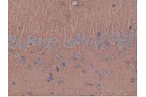IHC-P analysis of Rat Brain Tissue, with DAB staining. (Aquaporin 4 anticorps  (AA 179-314))