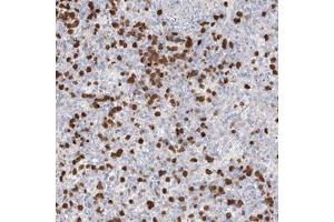 Immunohistochemical staining of human spleen with ZNF227 polyclonal antibody  shows strong cytoplasmic positivity in subsets of cells in red pulp at 1:500-1:100 dilution. (ZNF227 anticorps)