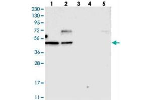 Western blot analysis of Lane 1: RT-4, Lane 2: U-251 MG, Lane 3: Human Plasma, Lane 4: Liver, Lane 5: Tonsil with TOX polyclonal antibody .