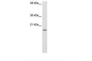 Image no. 1 for anti-Ribosomal Protein S14 (RPS14) (C-Term) antibody (ABIN203014) (RPS14 anticorps  (C-Term))