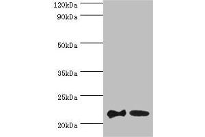 Western blot All lanes: SRI antibody at 2 μg/mL Lane 1: HepG2 whole cell lysate Lane 2: Hela whole cell lysate Secondary Goat polyclonal to rabbit at 1/10000 dilution Predicted band size: 22, 21 kDa Observed band size: 22 kDa (SRI anticorps  (AA 1-198))