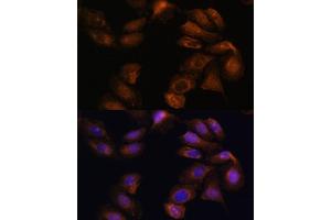 Immunofluorescence analysis of U-2 OS cells using ROBO1 Polyclonal Antibody (ABIN7270110) at dilution of 1:100 (40x lens).