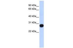 Image no. 1 for anti-Transcription Elongation Factor A (SII)-Like 4 (TCEAL4) (AA 107-156) antibody (ABIN6741080) (TCEAL4 anticorps  (AA 107-156))