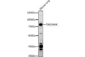 Western blot analysis of extracts of Mouse lung, using TBK1/NAK antibody (ABIN3016267, ABIN3016268, ABIN3016269 and ABIN6219678) at 1:1000 dilution.