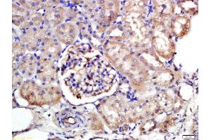 Formalin-fixed and paraffin embedded rat kidney labeled with Rabbit Anti-NTCP/SLC10A1 Polyclonal Antibody, Unconjugated  at 1:200 followed by conjugation to the secondary antibody and DAB staining (SLC10A1 anticorps  (AA 21-120))