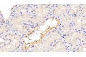 Detection of C3a in Human Kidney Tissue using Polyclonal Antibody to Complement Component 3a (C3a)