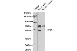 Western blot analysis of extracts of various cell lines, using CES2 antibody (ABIN6134283, ABIN6138436, ABIN6138437 and ABIN6217717) at 1:1000 dilution.