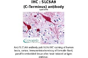 Image no. 1 for anti-Solute Carrier Family 5 (Sodium/glucose Cotransporter), Member 9 (SLC5A9) (C-Term) antibody (ABIN1739408)